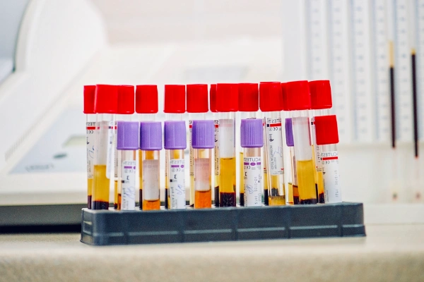What is PRP Therapy?