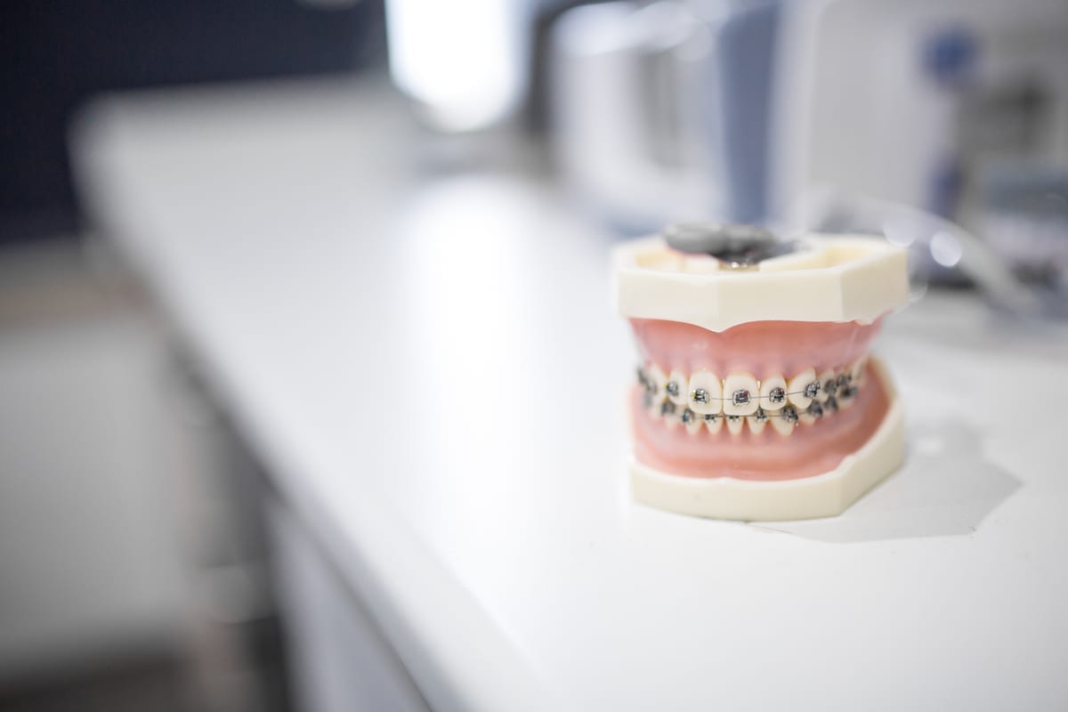 Featured image for “Early Orthodontics in Rockville, CT | Dr. Jay Family Dental”