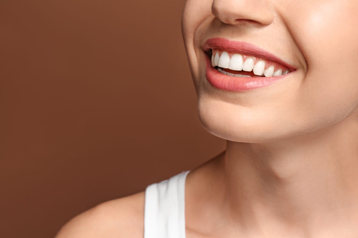 Featured image for “Teeth Whitening Timeline in Vernon, CT”