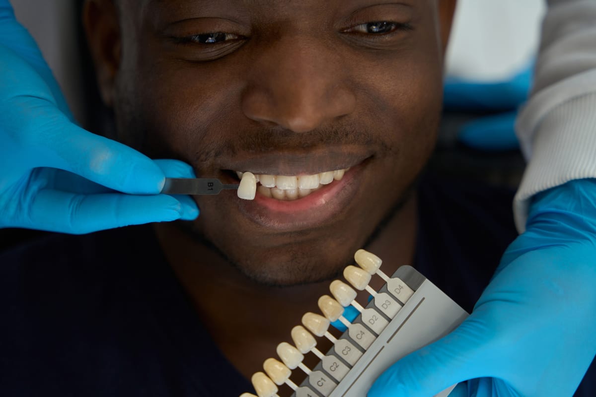 Featured image for “Porcelain vs. Composite Veneers in Vernon, CT”