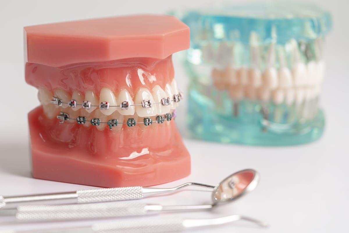 Featured image for “5 Orthodontics Questions New Patients Ask Us Most”