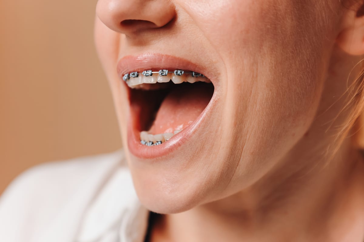 Featured image for “Your First Orthodontic Appointment: What to Expect and How to Prepare”
