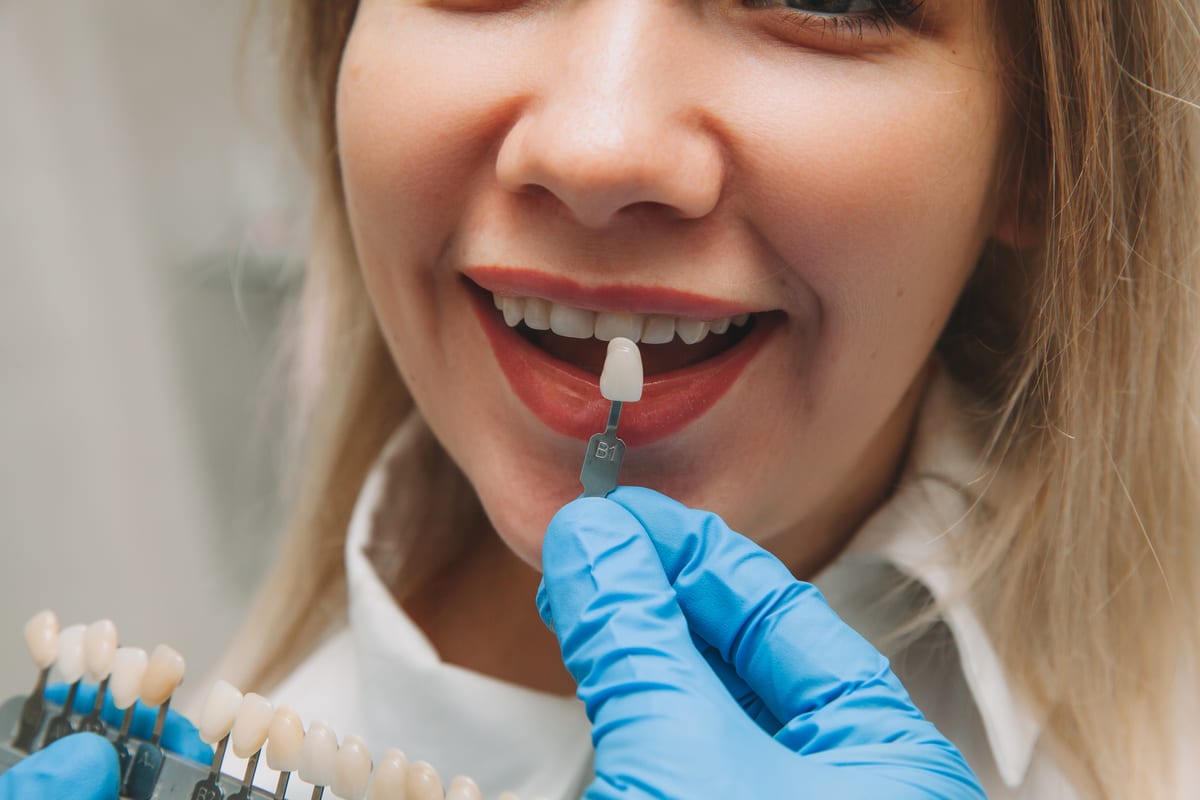 Featured image for “Veneers Won’t Fix Everything: What They Actually Solve”
