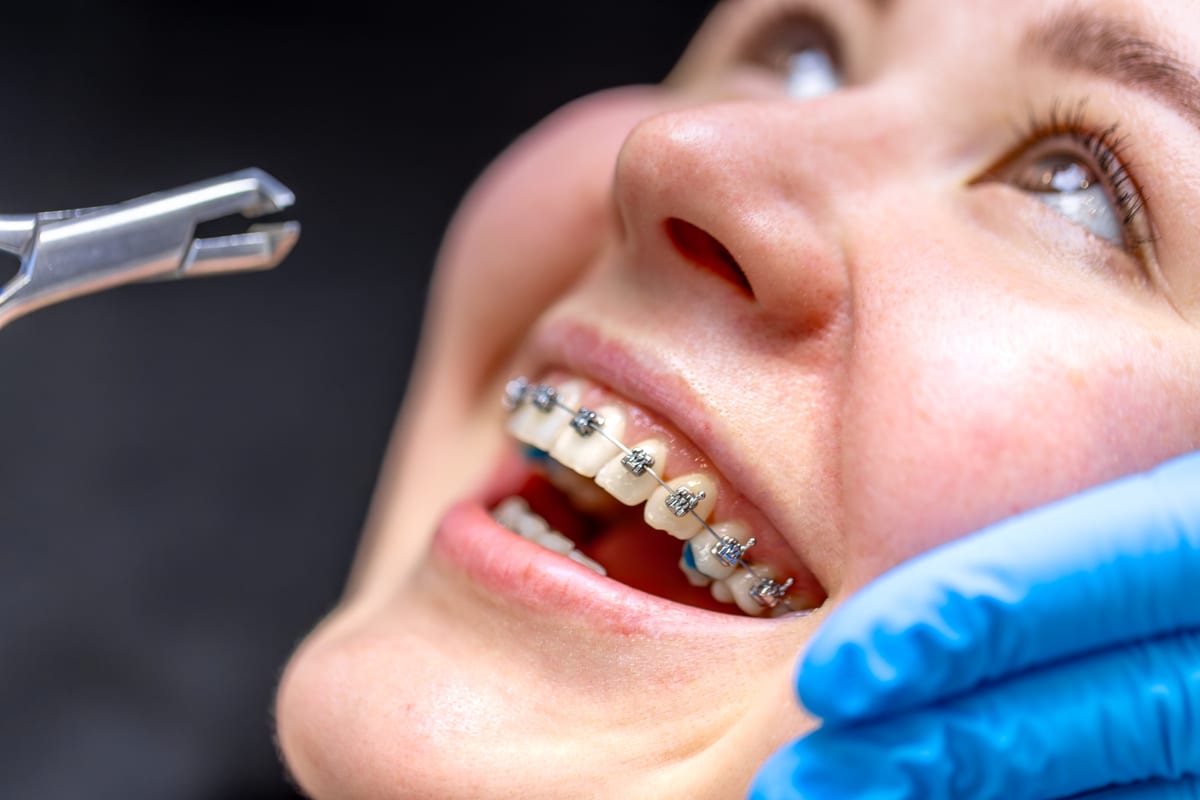 Featured image for “Why Delaying Orthodontics Often Costs More Than Straight Teeth”